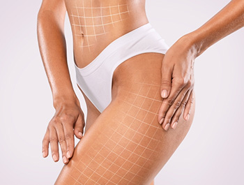 Cellulite Treatment | Non-Invasive Body Contouring