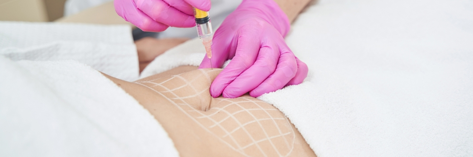 nonsurgical-body-contouring