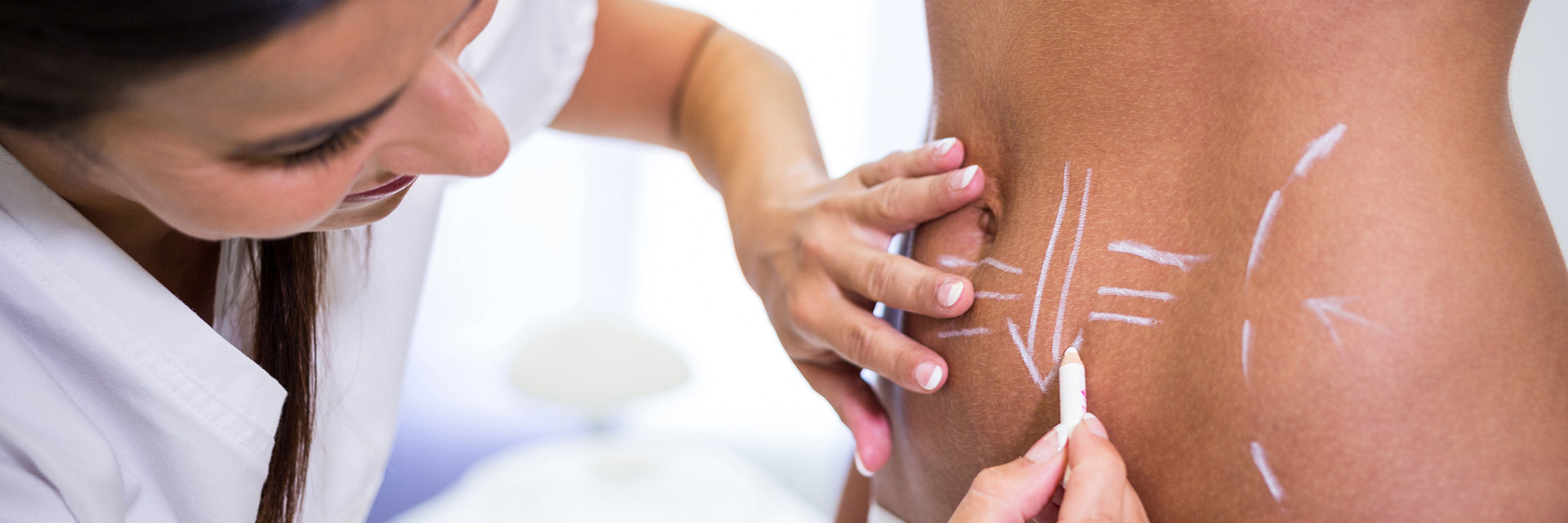 Tight Sculpting laser treatment